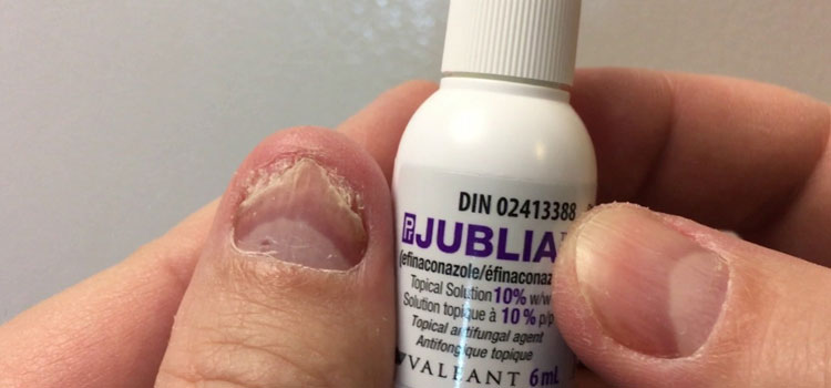 order cheaper jublia online in South Kensington, MD